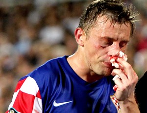 o atacante croata Ivica Olic fraturou o nariz jogando pela croácia