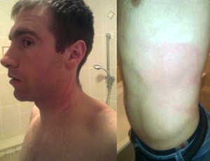 Nikola Nikezic, atacante do Kuban, agredido (Foto: Reprodução)