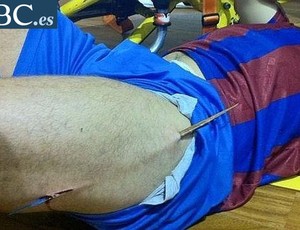 jogador de futebol de salão Barcelona ferido (Foto: Reprodução/ABC.es)