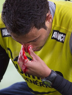 Welder sangrando durante treino do Corinthians (Foto: Ag. Estado)