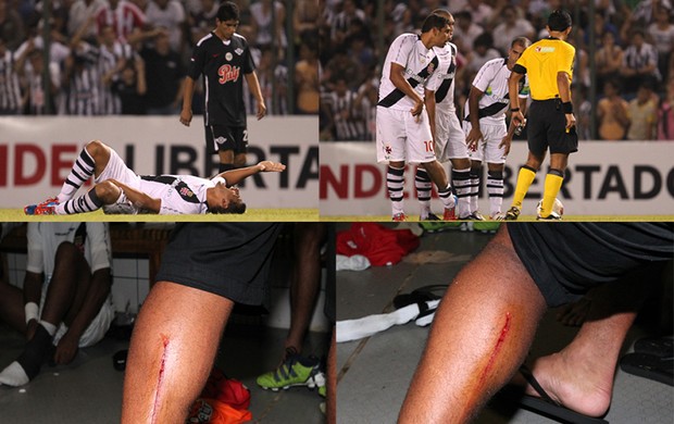 Diego Souza Vasco perna machucada (Foto: Site Oficial do vasco)