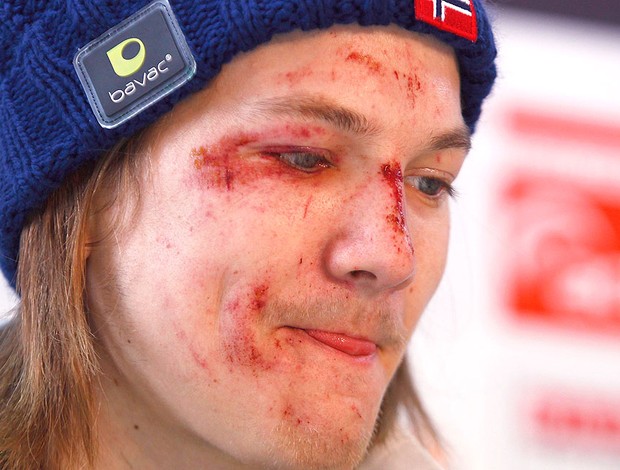 Tom Hilde após queda na prova de salto em esqui (Foto: Reuters)