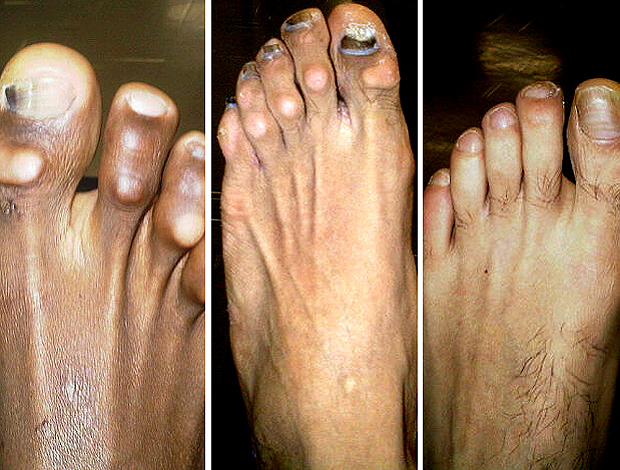 pés corinthians