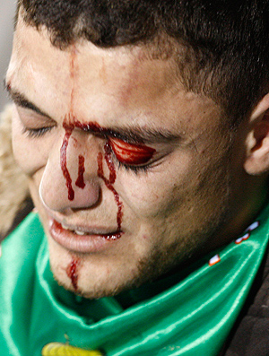 Torcedores machucados na Jordânia no jogo Al Wehdat x Al Faisali