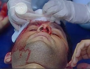 FRAME - Capacete bate de cabeça na parede e se machuca na partida entre Tigres e Corinthians (Foto: Reprodução/Sportv)
