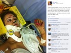 Integrante do reality show 'Casa Bonita' sofre acidente de moto