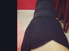 'Não vou parar de fazer shows', diz Mulher Melancia após torcer joelho