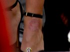 Britney Spears sai de hotel e deixa à mostra machucado no pé