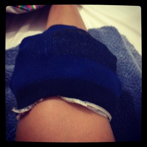 Mulher Melancia trata do joelho torcido com gelo (Foto: Instagram/ Reprodução)