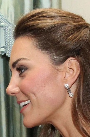 Cicatriz de Kate Middleton (Foto: Getty Images)