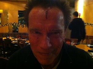Arnold Schwarzenegger mostra machucado na testa no Twitter  (Foto: Twitter)