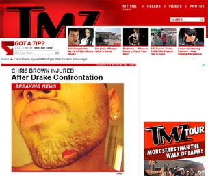 Chris Brown machucado (Foto: TMZ/Reprodução)