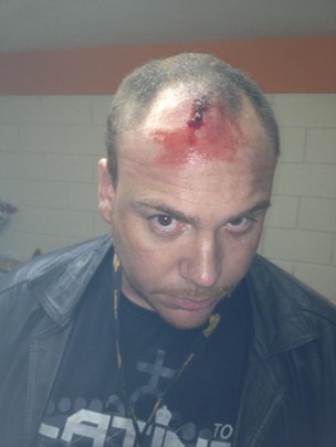 Russo, produtor do cantor Latino, com ferimento na cabeça após agressão antes de shows em Nazareno, Minas Gerais (Foto: Twitter/ Reprodução)