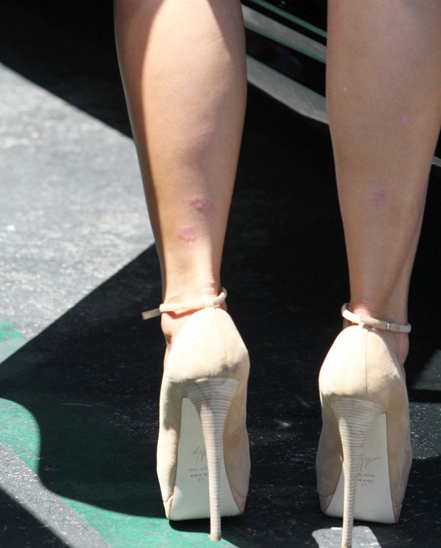 Kim Kardashian exibe marcas estranhas nas pernas (Foto: X17/Agência)