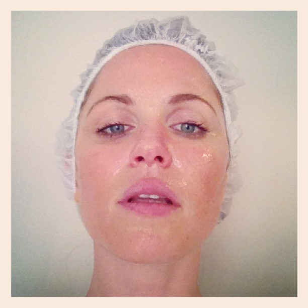Susana Werner se prepara para fazer tratamento a laser no rosto e posta foto no Twitter (Foto: Twitter/Reprodução)