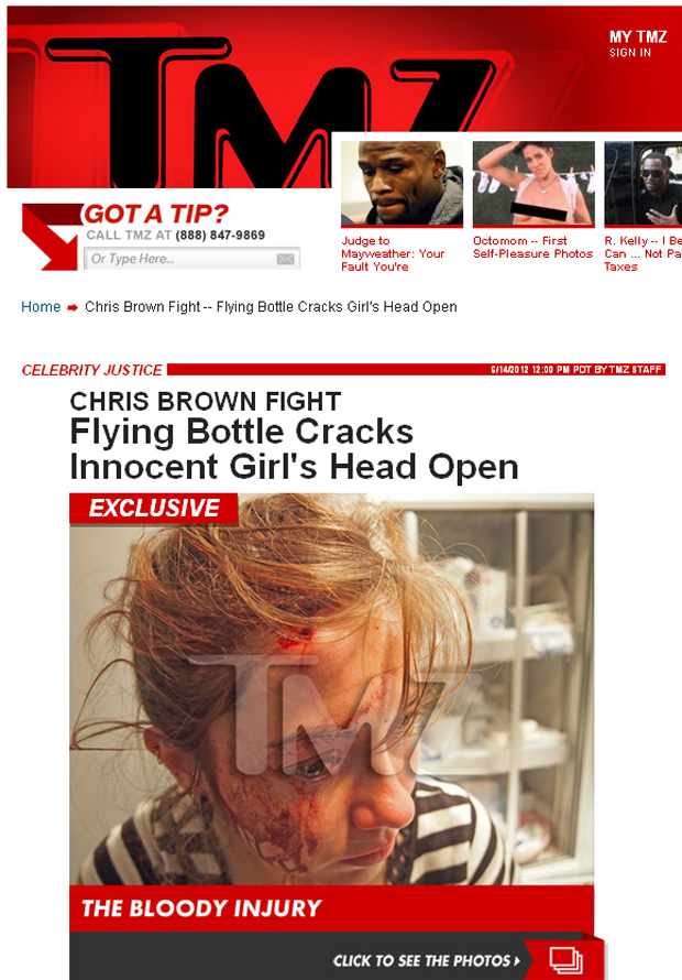 Menina machucada após briga de Chris Brown em boate (Foto: TMZ / Reprodução)