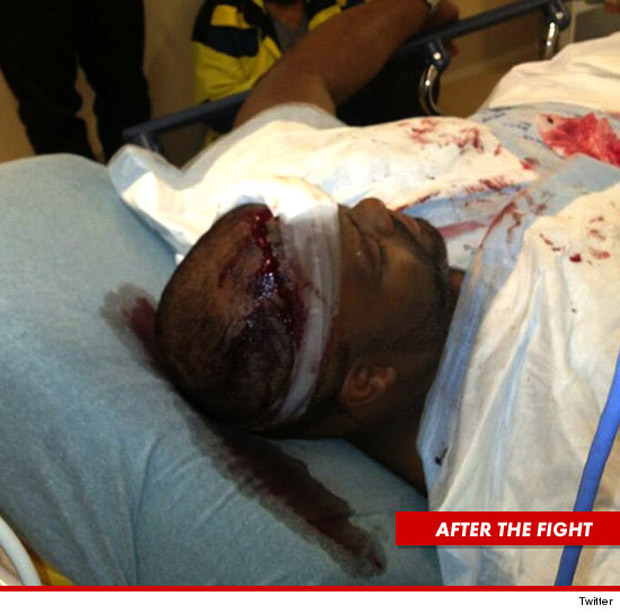 Segurança de Chris Brown machucado após briga (Foto: Twitter / Reprodução)