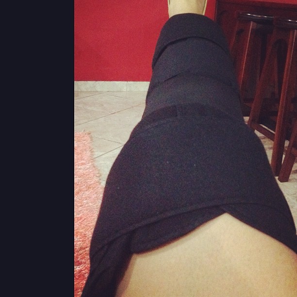 Mulher Melancia posta foto da perna machucada (Foto: Instagram / Reprodução)