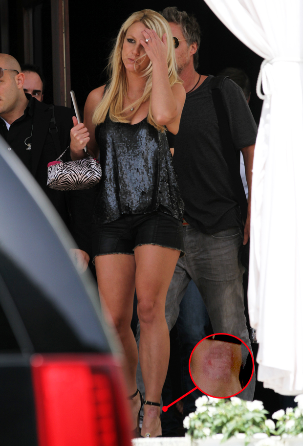 Britney Spears com machucado no pé (Foto: Grosby Group / Agência)