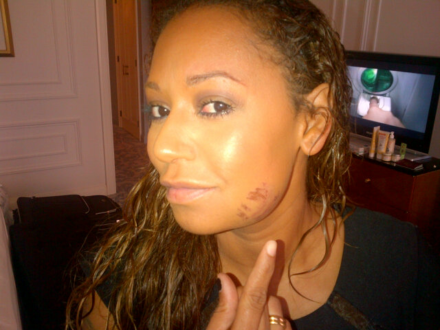 Mel B mostra machucado no rosto (Foto: Twitter/Reprodução)