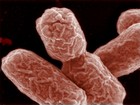 Versão de 'E. coli' alemã era diferente da francesa durante surtos em 2011