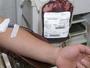 Risco de contrair HIV em transfusão é maior no Brasil que nos EUA