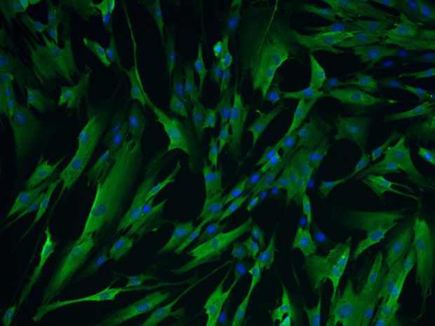 Pesquisadores do MIT usaram RNA para induzir fibroblastos (células do tecido conjuntivo) a expressarem quatro genes para reprogramá-las em estado imaturo