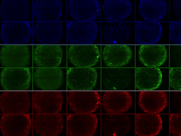 Células-tronco pluripotentes junto aos polímeros, para reprodução em larga escala. As cores são geradas para identificar detalhes como proteínas e o núcleo e cada unidade.