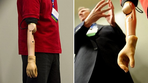Todd Kuiken apresenta o braço desenvolvido por ele e sua equipe que pode ser controlado por impulsos do cérebro (Foto: Jim Watson/AFP)