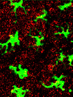 Células imunes, marcadas em verde fluorescente, cercadas pelas nanopartículas (vermelhas), depois da injeção em camundongos (Foto: Peter DeMuth and James Moon / MIT)