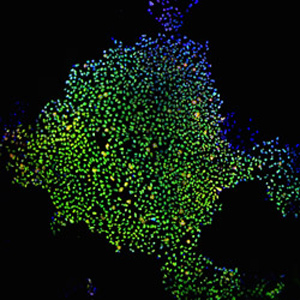 Células-tronco induzidas malefício 1 (Foto: James Thomson / Universidade de Wisconsin-Madison)