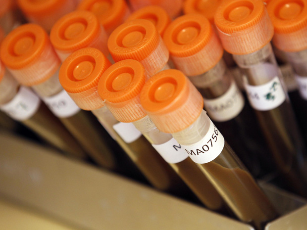 Tubos de ensaio com amostras de bactérias (Foto: Suzanne Plunkett/Reuters)