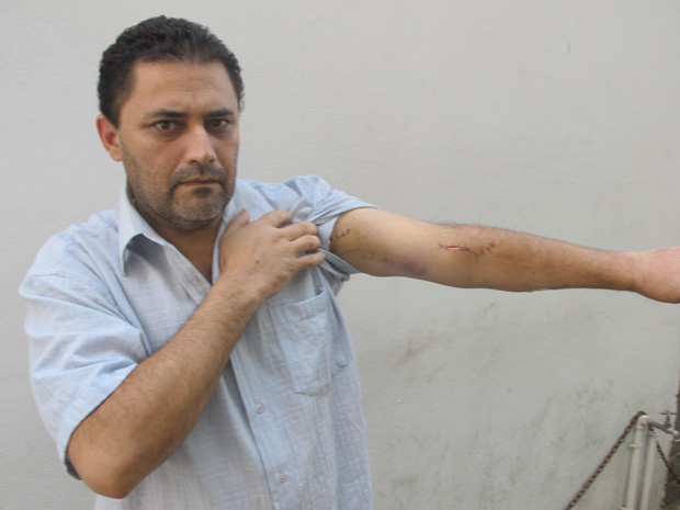 Esfaqueado na Paulista mostra ferimentos no braço (Foto: Letícia Macedo/ G1)