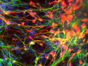 Células-tronco neurais 2 (Foto: Escola de Medicina da Universidade da Califórnia, San Diego)