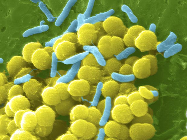 Bactéria antibióticos 1 (Foto: Institutos de Saúde dos EUA)