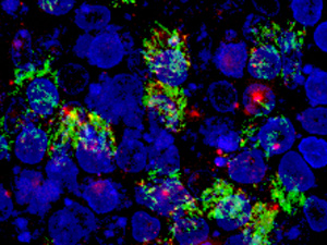 Em verde, a proteína TIM-1, em células das vias aéreas (Foto: University of Iowa / Divulgação)