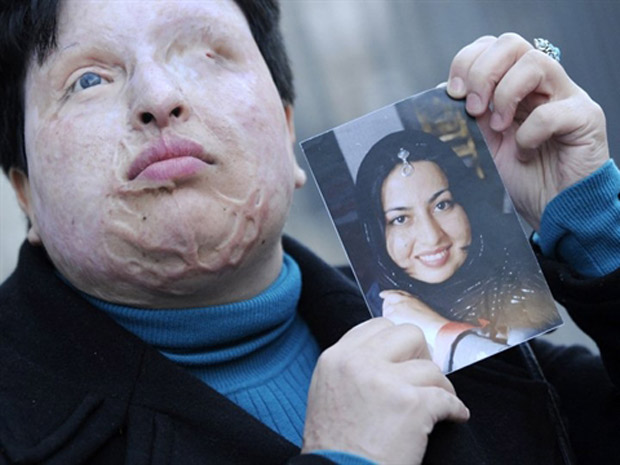 Irã mulher ácido 1 (Foto: Lluis Gene / AFP Photo)