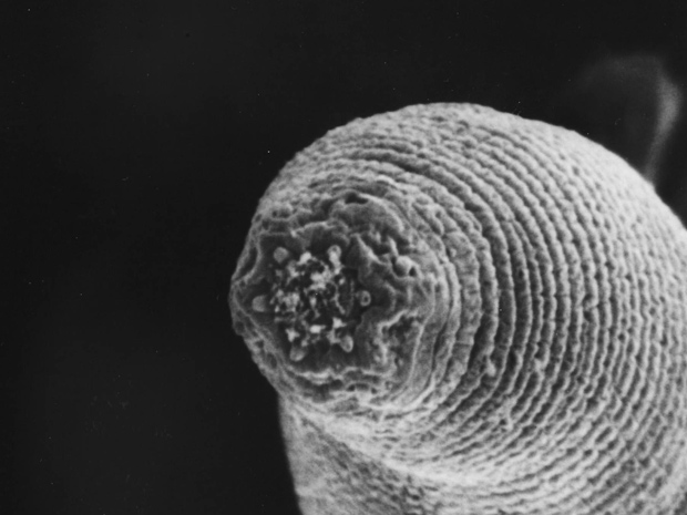 Nemátodo comedor de bactéria é nova espécie descoberta nas profundezas terrestres. (Foto: Gaetan Borgonie / Universidade de Gent)