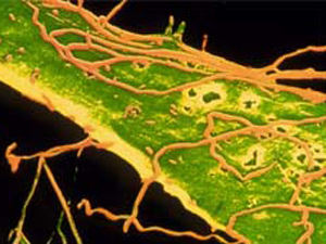 Doença é causada pela bactéria sexualmente transmissível 'Treponema pallidum'. (Foto: Science Photo Library / via BBC)