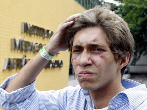Jovem prestou queixa após agressão em boate na Lagoa (Foto: Roberto Moreyra/Agência O Globo)