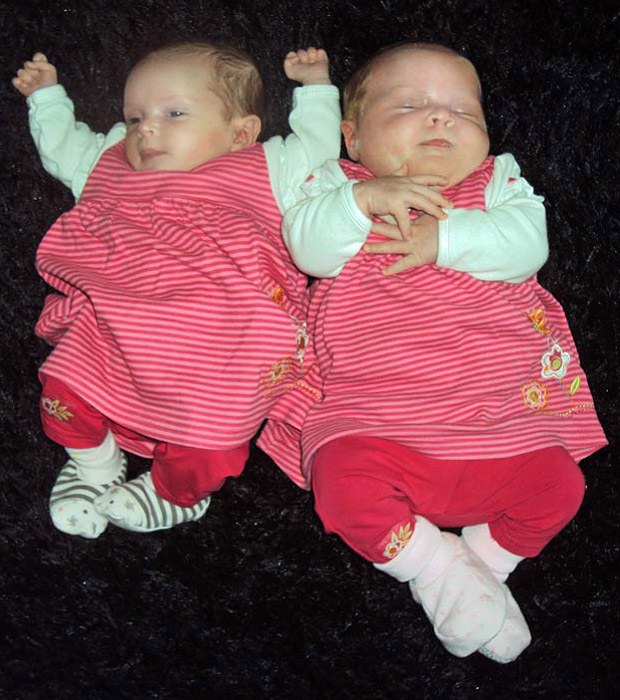 As gêmeas Daisy (à direita) e Poppy Sutherland posam em Portsoy, Aberdeenshire, na Escócia. Daisy nasceu com 3,65 quilos, e Poppy, com 2,46 quilos, no hospital e maternidade Elgin, há cinco semanas. As gêmeas nasceram saudáveis, com o que a imprensa britânica chamou a maior diferença de peso entre gêmeos já registrada no Reino Unido (Foto: Worldwide Features/Barcroft Media/Getty Images)