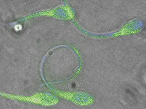 Espermatozóides normais são capazes de alcançar e fecundar o óvulo  (Foto: Ted Tollner/UC Davis)