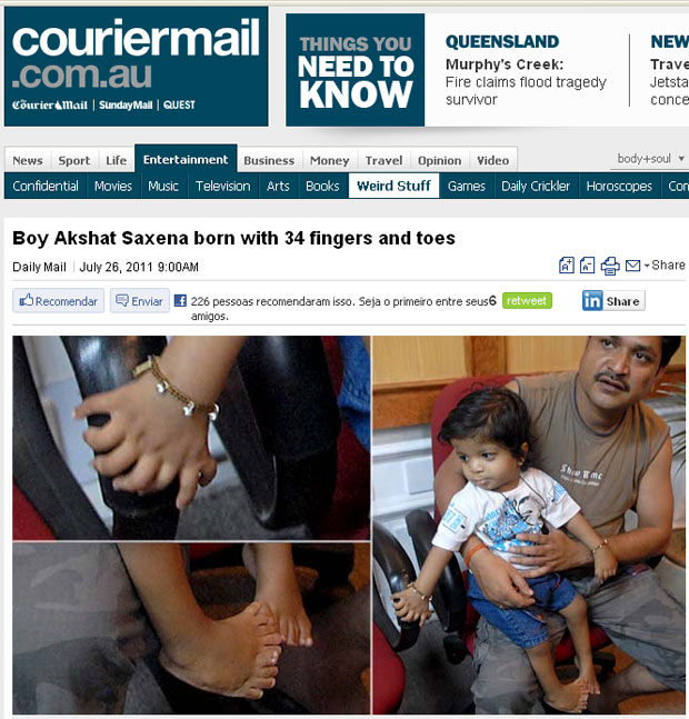 Akshat é visto com o pai antes de uma operação para amputar dedos sobressalentes (Foto: Reprodução/Courier Mail)