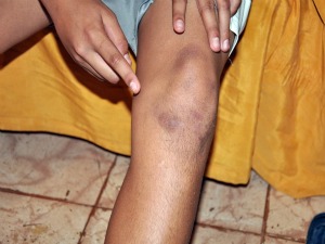 Menino de 12 anos diz que foi agredido por cinco colegas de escola em Campo Grande (Foto: Ricardo Campos Jr./G1 MS)