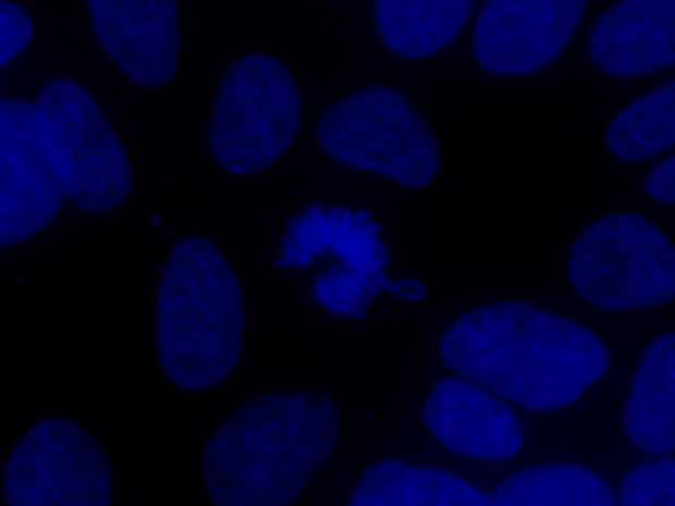 Núcleo de célula cancerosa, sem o STAG2 (Foto: Science / AAAS)