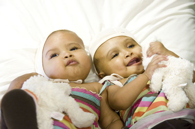 Operação para separar gêmeas siamesas foi bem sucedida (Foto: Facing the World/BBC)