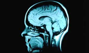 Estimular cérebro com eletricidade acelera aprendizado, diz estudo (Foto:  Corbis Royalty Free)