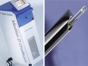 À esquerda, o equipamento que produz os raios laser; à direita, a sonda que leva os raios até a próstata. (Foto: Divulgação)