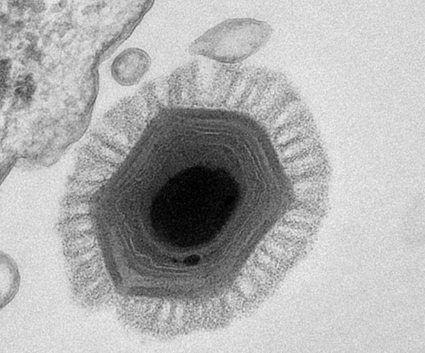 Imagem mostra estrutura do vírus 'Megavirus chilensis'. (Foto: C. Abergel / IGS-CNRS / AFP Photo)