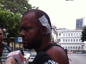 Luiz Claudio passava pela rua quando a explosão o atirou no chão (Foto: Lilian Quaino/G1)